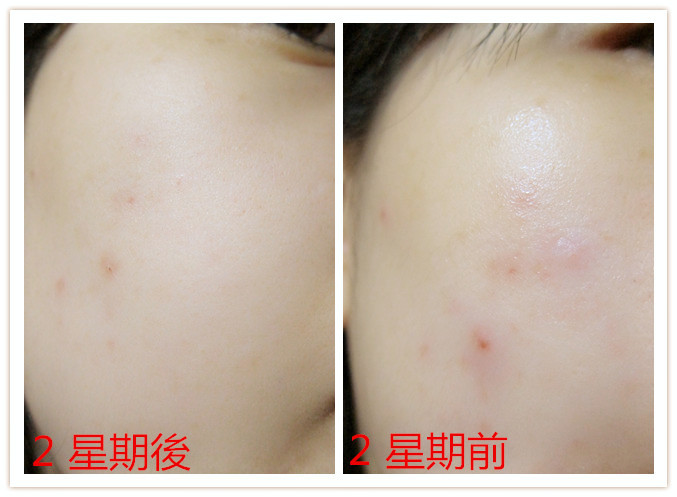 Cosmetic Skin Solutions Soothing B5 Peptide Gel Advanced Formula的圖片搜尋結果