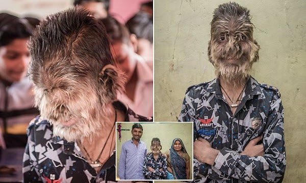 Hombre lobo en la india. Hombre lobo en la india.