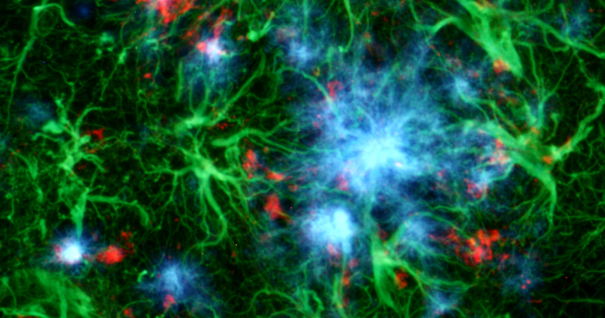 Newmarket Scientific Amyloid beta plaque staining