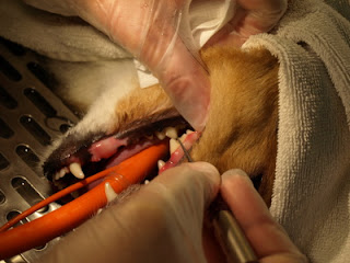 A curette is used to remove plaque and tartar under the gums.