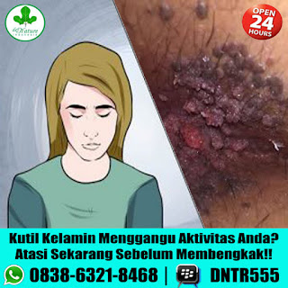 Obat Kutil Kelamin