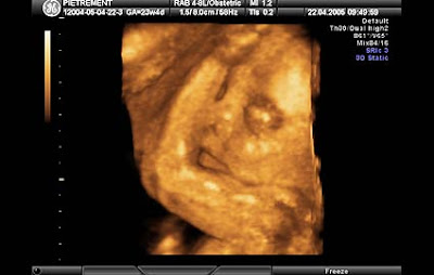 23 haftalık gebelik görüntüsü