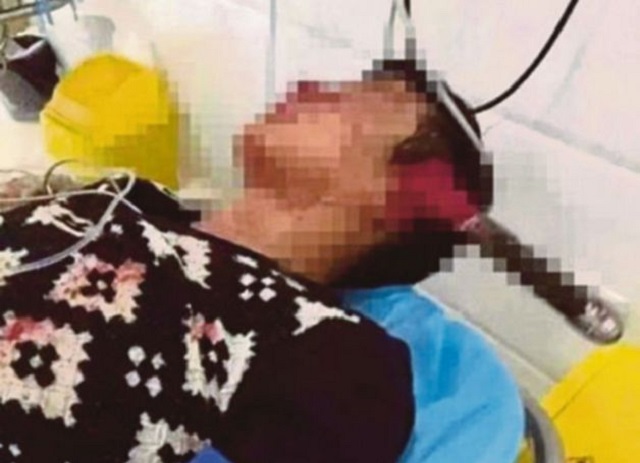 Ditikam Di Kepala: Berpantang Maut Sebelum Ajal Ditikam Di Kepala: Berpantang Maut Sebelum Ajal