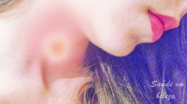 Dores de garganta, causas e tratamentos