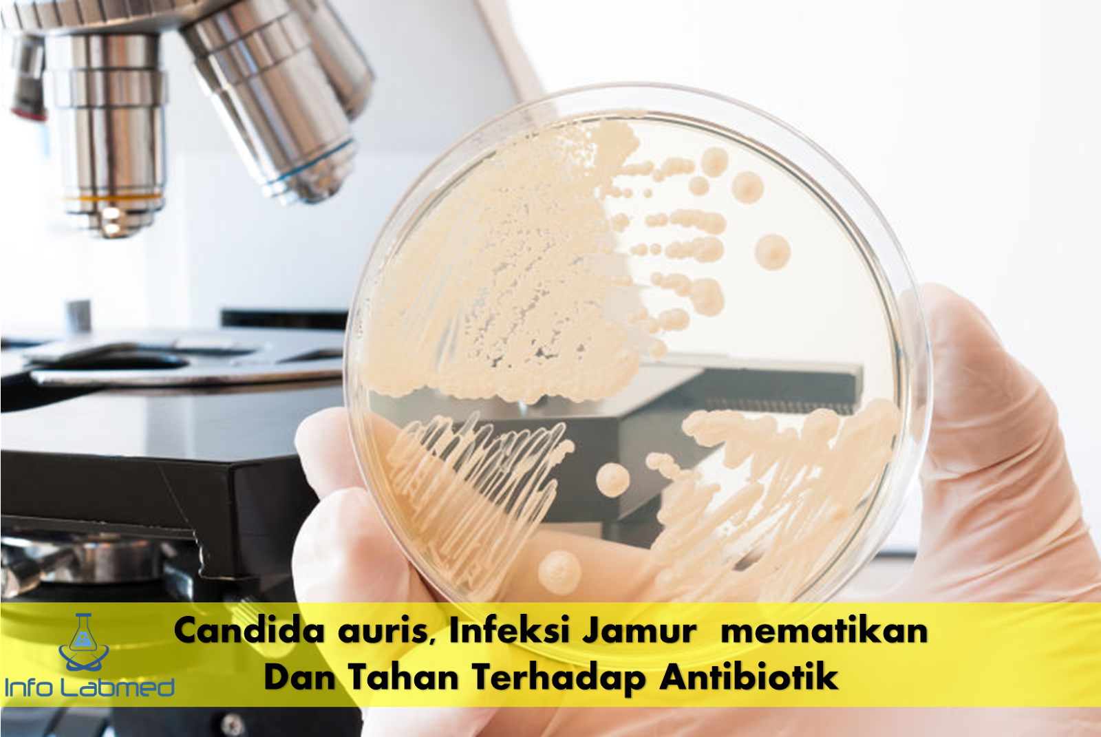 Infeksi Jamur Mematikan yang Tahan Terhadap Pengobatan