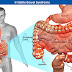 Irritable Bowel Syndrome (IBS) Definition, Causes, Diagnosis and Treatment Irritable Bowel Syndrome (IBS) Definition, Causes, Diagnosis and Treatment