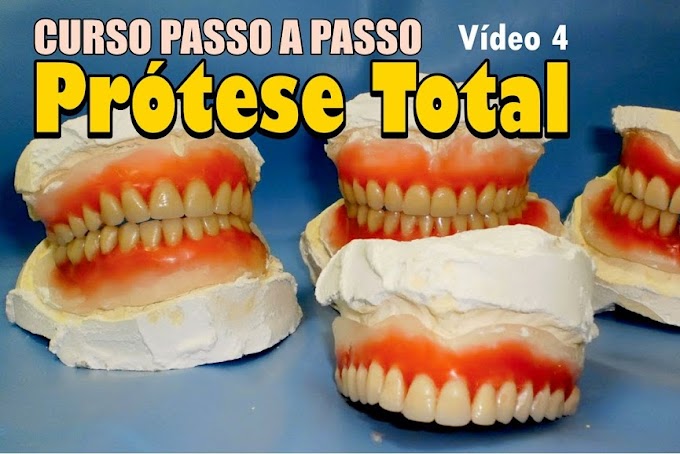 MUFLA EM PRÓTESE TOTAL: Curso passo a passo - Video 4