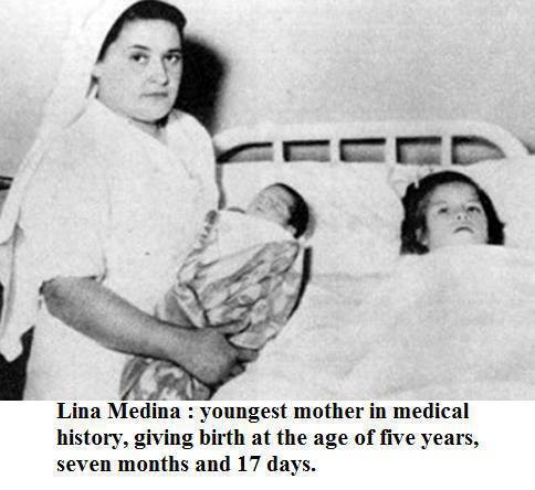 The Youngest Mother in Medical History - Lina Medina