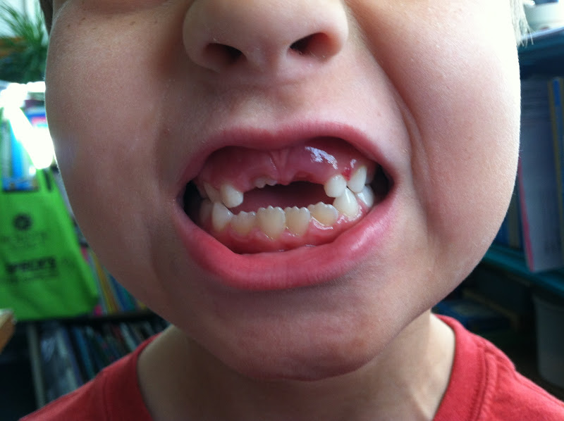 Dangling Tooth Mrs. Connor's classroom blog: November 2012