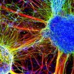 Neurons derived from schizophrenic patients: