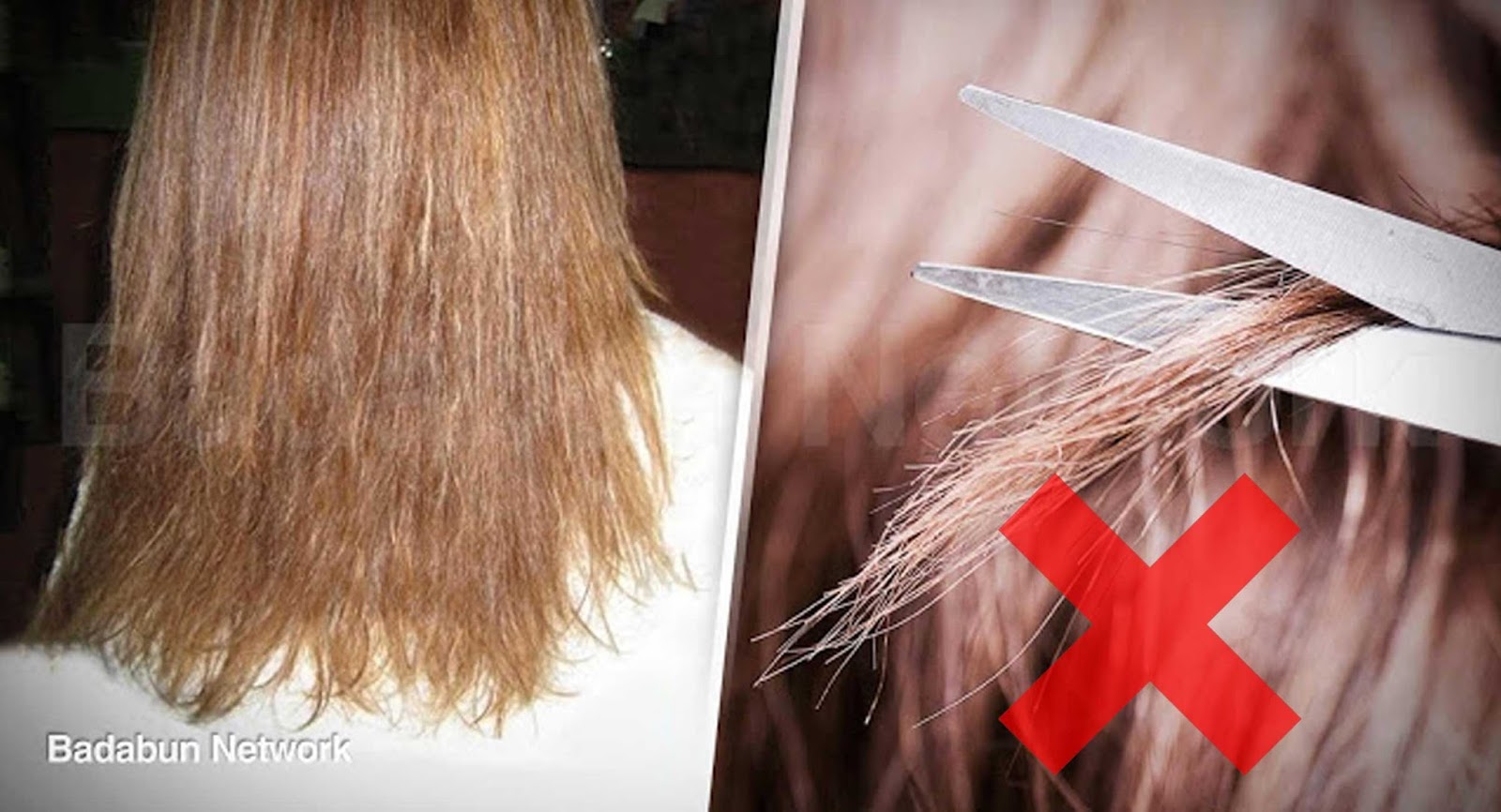 El mejor medio contra la alopecia a los hombres