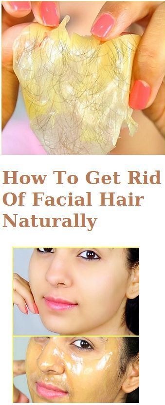How to get rid of little hairs on face Clearance