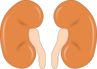 Kidney stone causes symptom treatment in hindi