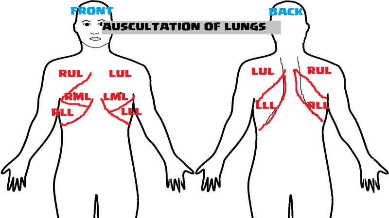 LOCATIONS FOR AUSCULTATION - STETHOSCOPE PLACEMENT