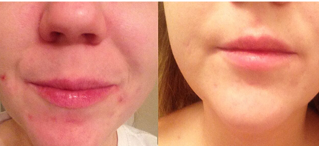 clear days ahead face wash