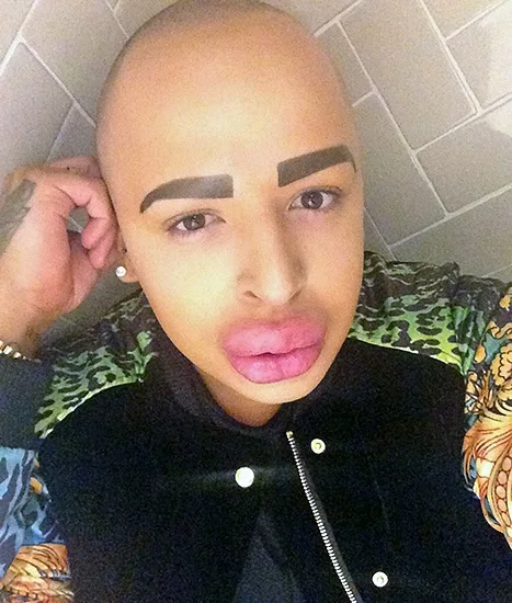 Gorgeous 'botched' Star Jordan James Parke Dies At 34 View in 4K Gorgeous 'botched' Star Jordan James Parke Dies At 34 View in 4K