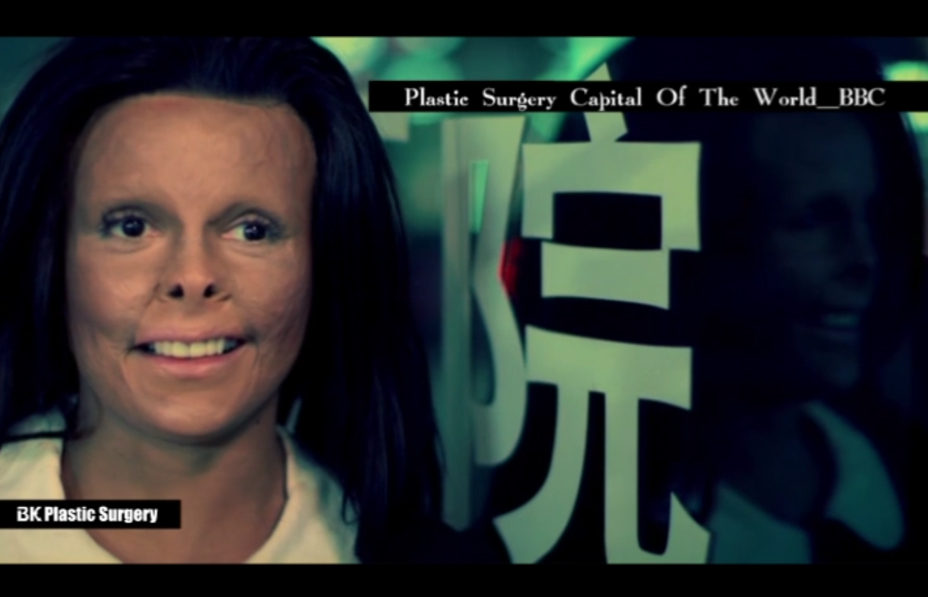 BK HospitalPlastic Surgery [UK BBC Documentary] BK Plastic Surgery Hospital, aired on UK BBC
