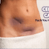 ROMPIENDO: CNN - 7 SIGNOS DE CÁNCER CERVICAL QUE LAS MUJERES NECESITAN OBSERVAR