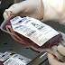 Menos de 2% da população doa sangue no Brasil