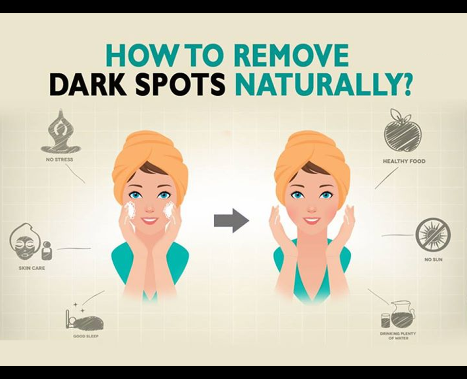 Health How To Remove Dark Spots Naturally health-how-to-remove-dark-spots-naturally