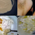 ودعي شعر جسمك و الرائحة الكريهة لمدة 5 سنوات مع هذه الوصفة الطريقه مضمونه 100%