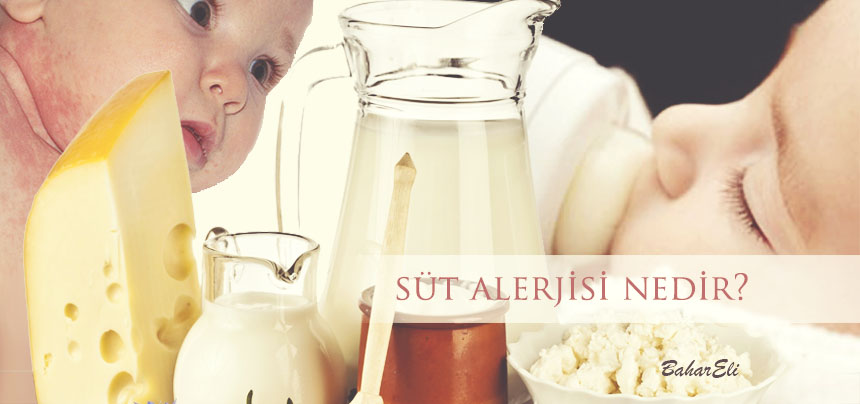 Sut Alerjisi Nedir Anne Bebek Ve Cocuga Dair Her Sey