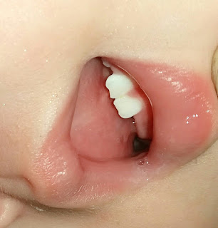 cooling gel for teething babies