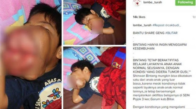 Sungguh Kasihan Melihat Kondisi Memprihatinkan Bocah Kelas 3 SD ini Sungguh Kasihan Melihat Kondisi Memprihatinkan Bocah Kelas 3 SD ini