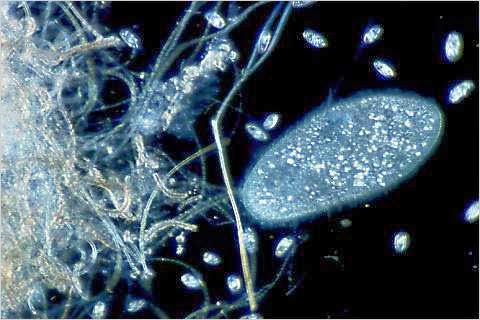Zat yang dapat menghambat pertumbuhan mikroorganisme lain seperti bakteri protozoa dan jamur adalah