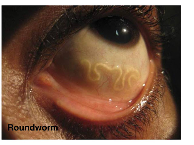 How Common Are Parasites In Humans How Common Are Parasites In Humans