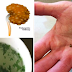 Flush Out Your Kidney Stones Instantly Using Parsley Leaves