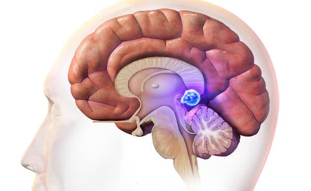 ‘Con mắt thứ ba’(P2): Thực tế não của những người đặc biệt có một con mắt ‘Con mắt thứ ba’(P2): Thực tế não của những người đặc biệt có một con mắt