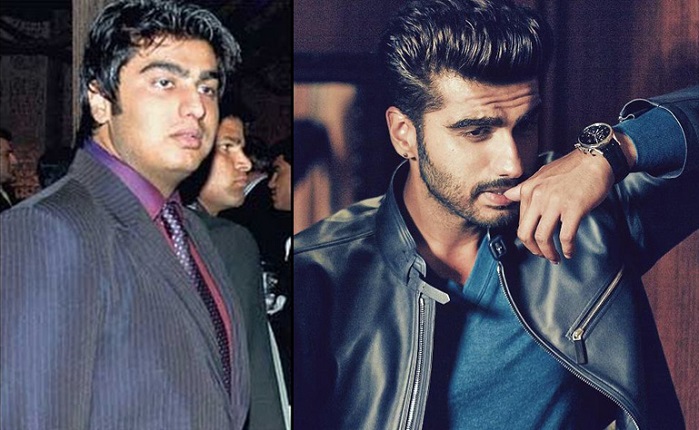 Allu Arjun Before And After Plastic Surgery