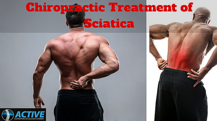 Treatment of Sciatica