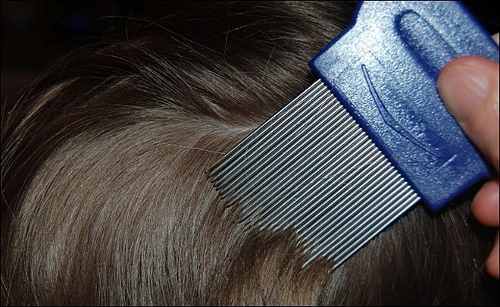 10 remedios caseros para eliminar los piojos - Salud y Vida