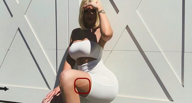 Kylie Jenner muestra gran cicatriz en su pierna