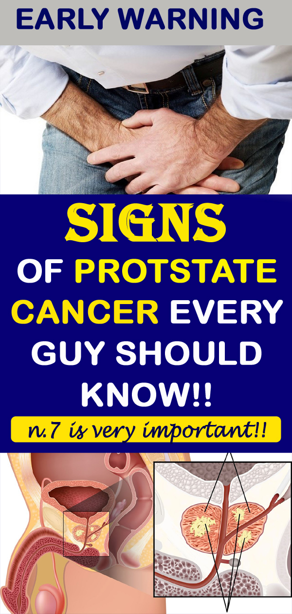 12 Early Warning Signs Of Prostate Cancer That Every Guy Needs To Know ...