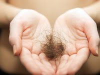 Daftar Penyakit Yang Menyebabkan Rambut Rontok Daftar Penyakit Yang Menyebabkan Rambut Rontok