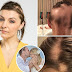 Mulher perde 90% dos cabelos depois de passar por estresse planejando casamento