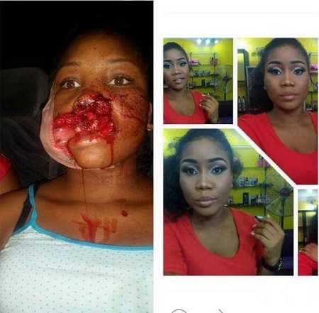 Too Heartless! Pretty Girl Shot in The Mouth in Aluu, Rivers State (Graphic Photos)