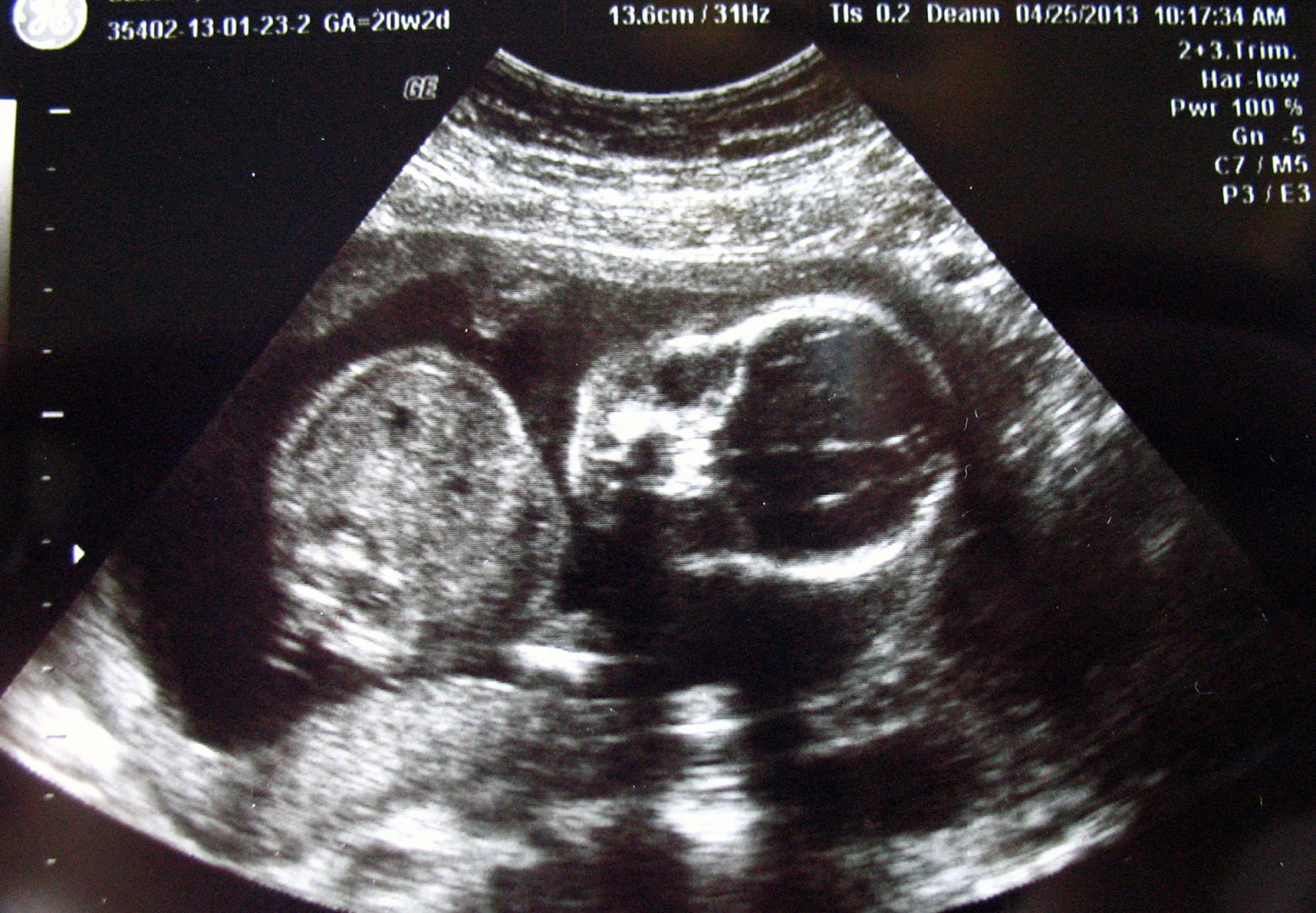 more than 9 to 5...my life as "Mom" Baby Bump Update Week 20