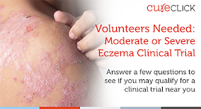 Moderate to Severe Eczema