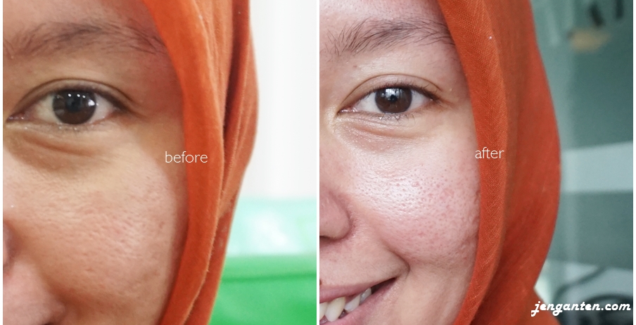 Treatment Review Serunya Facial Di Naavagreen Land Of Jenganten