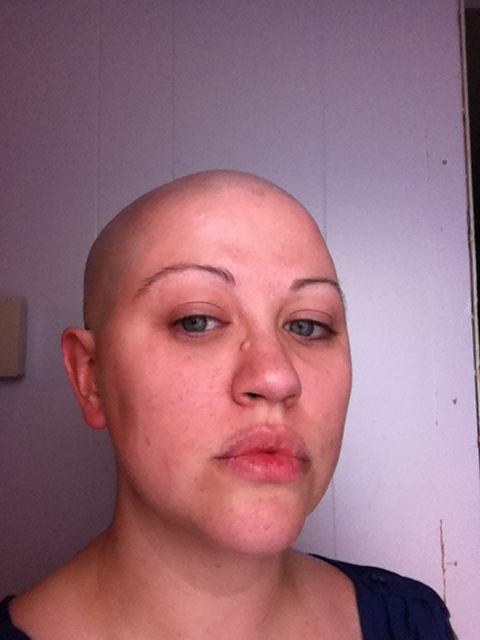 Finding My Voice: Update: My Shiny Bald Head