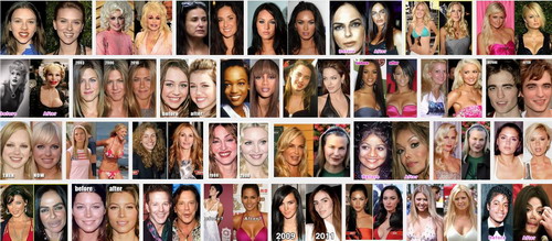 Celebrity Plastic Surgery Before And After Funtuna