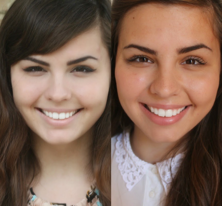 Smile Brilliant Teeth Whitening Review! | Passing Whimsies