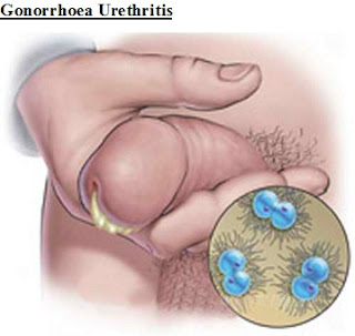 https://spesialisobatsipilisdankencingnanah.blogspot.com/2017/10/apa-obat-penis-keluar-nanah-dan-terasa.html