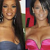 Did Rihanna Get A Boob Job ?