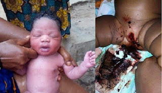 Image result for 11-Month-Old Baby Raped By Her Uncle Ogun Bleeds Endlessly (Graphic Photo)