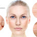 Latest Updates About What Causes Acne and How To Treat It ?